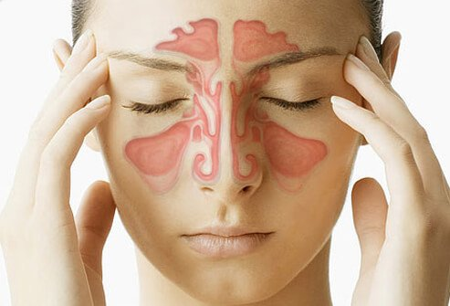 Como tratar sinusite